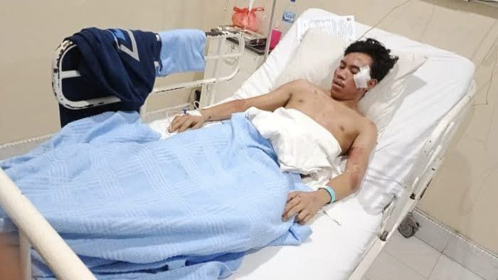 Kronologis Kecelakaan Maut di Jamin Ginting yang Menewaskan Seorang IRT