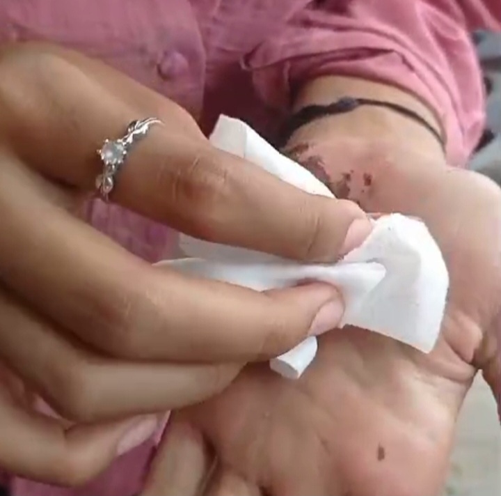 Penumpukan Sampah di KM 35 Pasar Jayanti Sebabkan Pengendara Motor Terjatuh