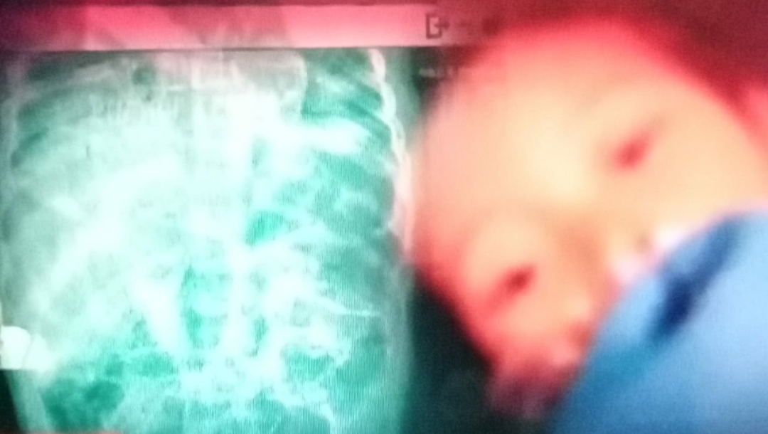 Kematian Raya Buka Luka Sukabumi, PWDPI Sukabumi Tuntut Aksi Nyata Pemerintah