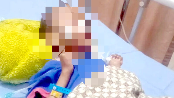 Tragedi Ahmad Maulana: Cermin Kegagalan Sistem Penanganan Gizi Buruk di Bogor