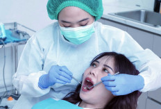 Implan Gigi Termurah Hadir di Indonesia, Semua Bisa Tanam Gigi