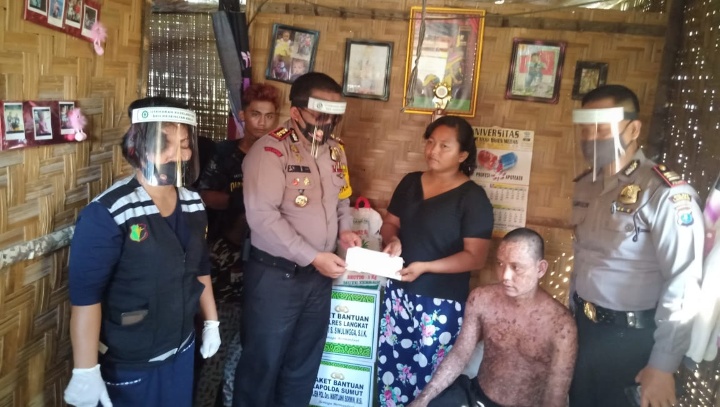 Kapolres Langkat AKBP Edi S Sinulingga ,SIK Berikan Bantuan Dari Kapolda Sumut Kepada Penderita Penyakit “Sind