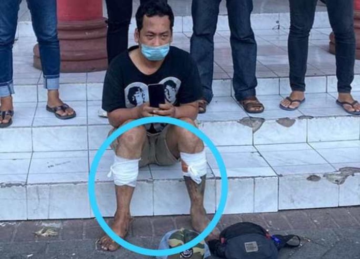 Berusaha Kabur Spesialis Jambret HP Didor Kakinya